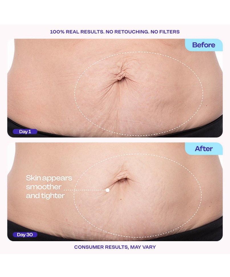Sculpt & Smooth Belly Cream (125 ML)