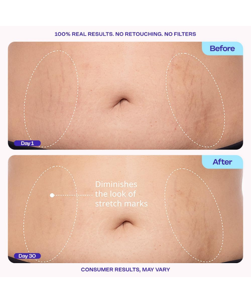 Sculpt & Smooth Belly Cream (125 ML)