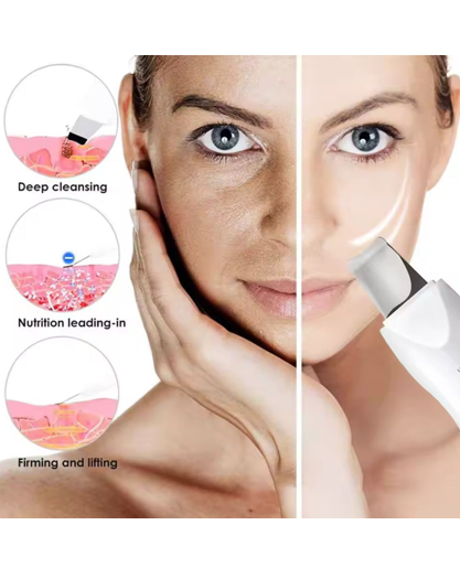 DermaGlow | Ultrasonic Shovel Cleanser For Deep Cleaning Skin, Scrubber, Peeling Facial Pore , Blackhead Cleaner